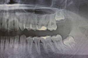 dentiste-chirurgie-bucale